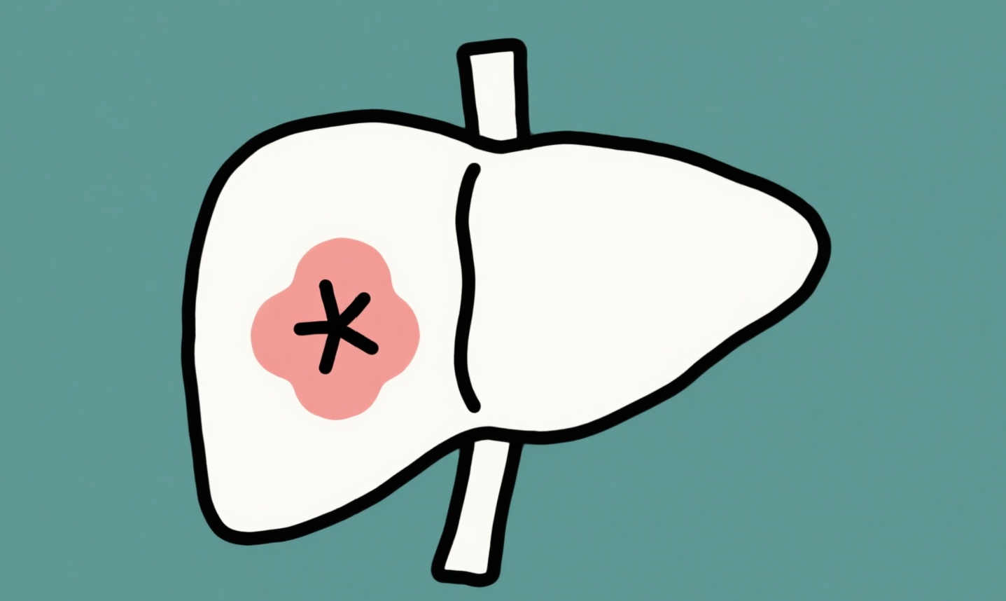 成都治癌症的老中医